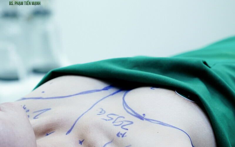 Tụt núm vú: Nguyên nhân và 3 cách khắc phục hiệu quả