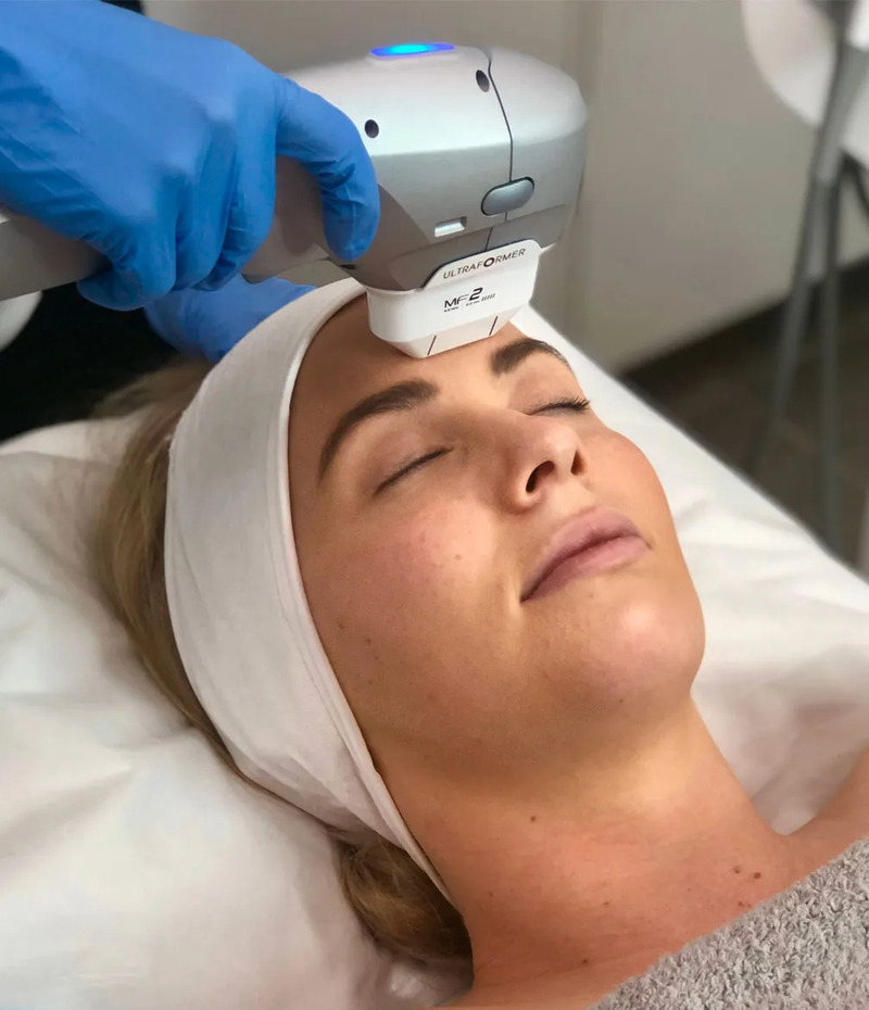 Ultherapy - Nâng cơ, xóa nhăn bằng sóng siêu âm hội tụ (Nguồn: Internet)