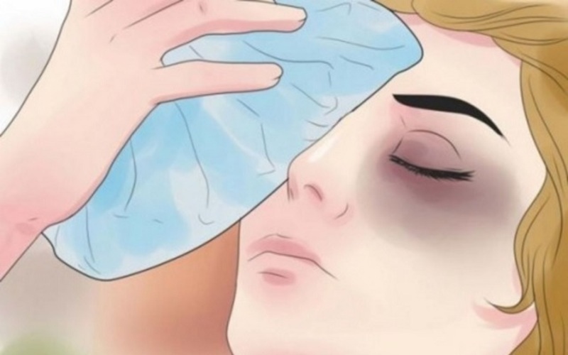 Xóa rãnh lệ bao nhiêu tiền? Bảng giá 2024