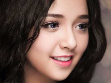 Nhấn mí đa điểm là một thủ thuật làm đẹp mới lạ và đòi hỏi kỹ thuật cao diễn ra nhanh chóng và đơn giản