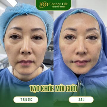 Đến với Thẩm Change Life- địa điểm uy tín để tạo khoé môi cười (Nguồn: MD Change Life)