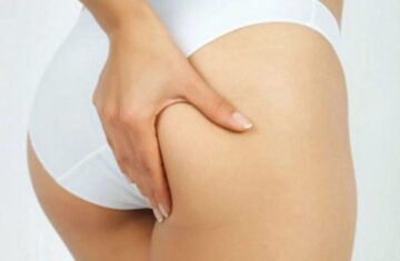 Cấy mỡ hõm mông giúp chị em có một vòng 3 căng tròn (Nguồn: Internet)