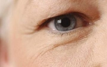 Quá trình lão hóa dẫn đến mắt bị trình trạng sụp mí ( Nguồn: Internet )