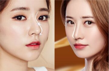 Dáng mũi S Line là dáng mũi được nhiều ưa chuộng (Nguồn: Internet)