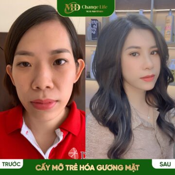 Trang chủ