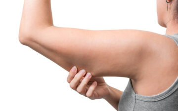 Hút mỡ bắp tay có nguy hiểm không?