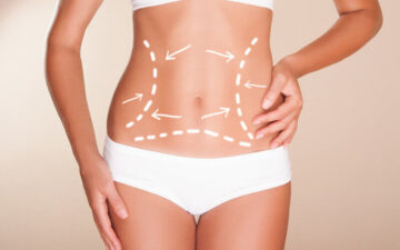 Hút mỡ bụng bao nhiêu tiền (Nguồn: Internet)