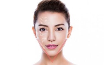 Hút mỡ mặt (Nguồn: Internet)