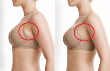 Giúp bạn lấy lại được dáng tay thon gọn (Nguồn: Internet)