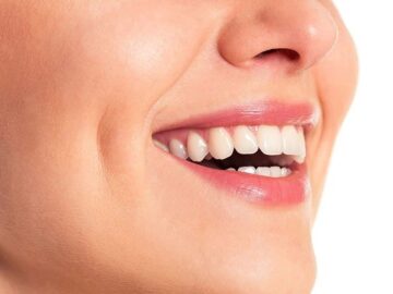 MÁ LÚM ĐỒNG TIỀN