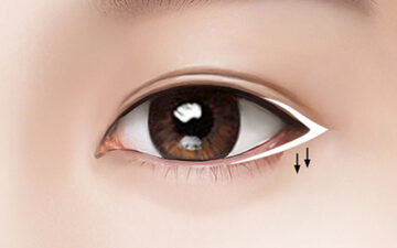 5 địa chỉ mở khóe mắt Hà Nội uy tín 2024