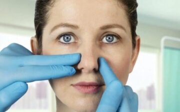 Các phương pháp nâng mũi bị lệch (Nguồn: Internet)