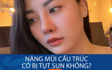 Nâng Mũi Cấu Trúc Có Bị Tụt Sụn Không? Sự Thật Cần Biết