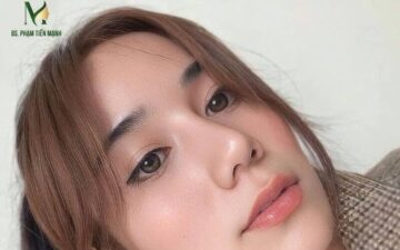 10 địa chỉ nâng mũi Hà Nội chất lượng