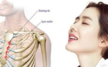 Thẩm Mỹ MD Change Life – Địa Chỉ Nâng Mũi Sụn Sườn Hà Nội Hoàn Hảo