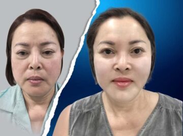 Thẩm mỹ MD - Nơi uy tín cho bạn lấy lại làn da căng, khoẻ, trẻ (Nguồn: Internet)