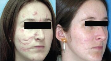 Thẩm mỹ MD Change life - Địa điểm uy tín để bạn sửa sẹo gương mặt (Nguồn: Internet)