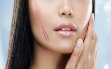 MD Change Life - Địa chỉ sửa sẹo gương mặt Hà Nội uy tín (Nguồn: Internet)