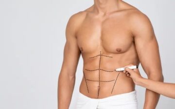 Lợi ích của phương pháp tạo hình 6 múi (Nguồn: Internet)