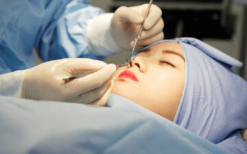 MD Change Life: Địa chỉ thu gọn cánh mũi Hà Nội (Nguồn: MD Change Life)