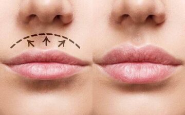 5 Địa Chỉ Thu Ngắn Nhân Trung Hà Nội 2024