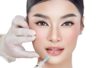 Tiêm giải filler (Nguồn: Internet)