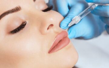 Tiêm tạo khoé cười (Nguồn: Internet)