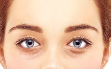 Rãnh lệ là như thế nào? (Nguồn: Internet)