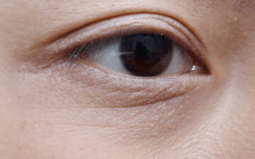 Rãnh lệ (Nguồn: Internet)